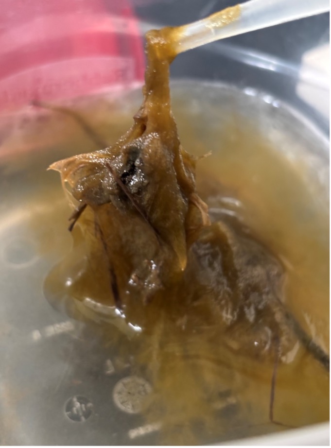photo of green algae Cladophora