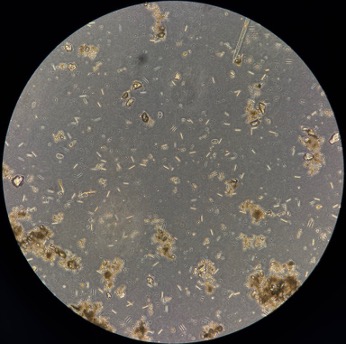 photo of microscope view showing diatoms